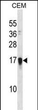 FAM163A Antibody (Center)