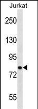 CACNB2 Antibody (Center)
