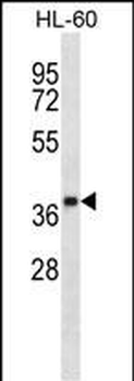 OR5F1 Antibody (C-term)