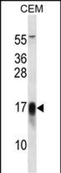 FXYD5 Antibody (Center)