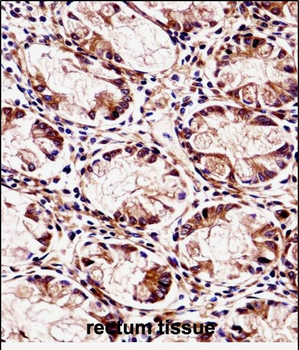 FXYD5 Antibody (Center)