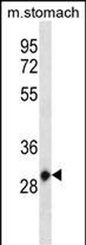 Mouse Hoxc12 Antibody (Center)