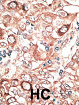 GJB2 Antibody (C-term)