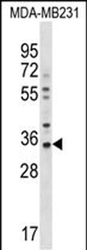 GJB5 Antibody (Center)