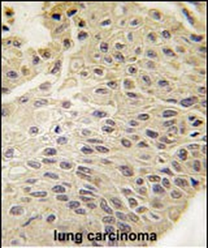 GJB5 Antibody (Center)