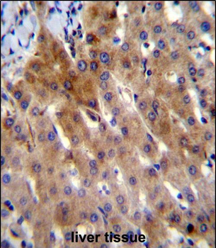 IL-17D Antibody (Center)