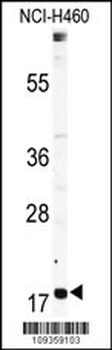 RPL23A Antibody (Center)