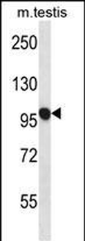 USP20 Antibody (C-term)