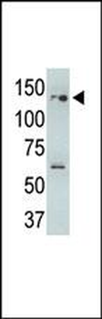 USP25 Antibody (N-term)