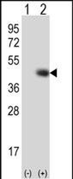 TPST1 Antibody (C-term)