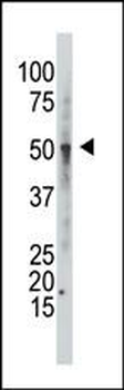 GCNT1 Antibody (C-term)