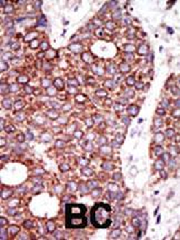 GCNT1 Antibody (C-term)