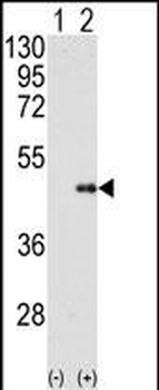 FNTB Antibody (N-term)