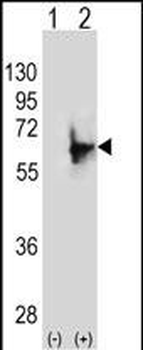 NMT2 Antibody (N-term)