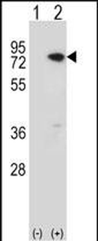 MeCP2 Antibody (C-term)