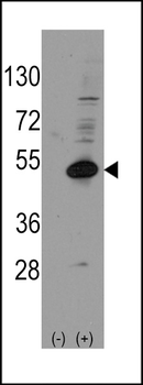 DAX1 (NR0B1) Antibody (C-term)