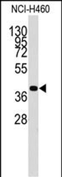 LECT1 Antibody (C-term)