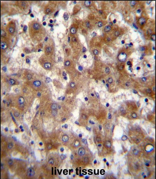 FUT4 Antibody (Center)