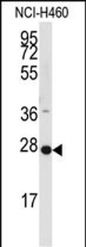 PPAP2C Antibody (C-term)