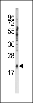SNRPC Antibody (C-term)