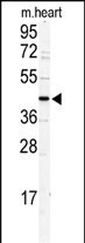 DCC1 Antibody (N-term)