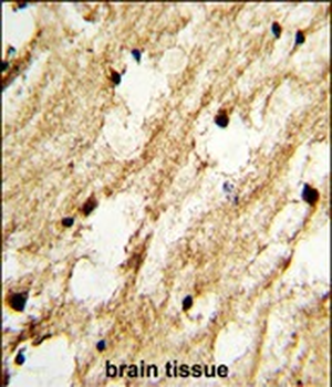 DCC1 Antibody (N-term)