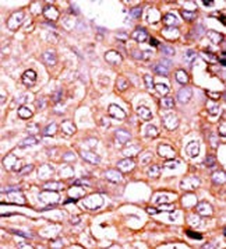 Phospho-EP300(S89) Antibody
