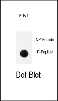 Phospho-TrkA(Y791) Antibody