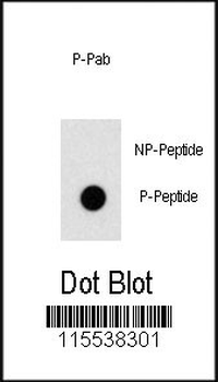 Phospho-OSR1(T310) Antibody