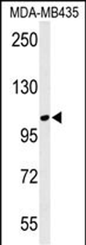 LUZP1 Antibody (C-term)