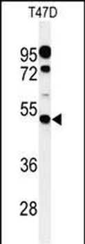 PIGM Antibody (C-term)