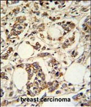 PIGM Antibody (C-term)