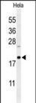 CLEC2B Antibody (Center)