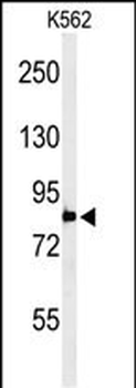 PLA2G4B Antibody (Center)