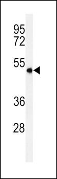 ASM3A Antibody (C-term)