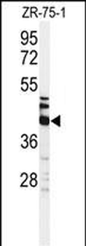 KRT35 Antibody (C-term)