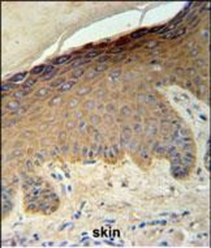 KRT35 Antibody (C-term)