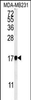 AP1S1 Antibody (N-Term)