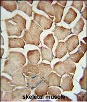 AP1S1 Antibody (N-Term)