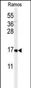 CMTM7 Antibody (N-term)