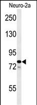 F91A1 Antibody (N-term)