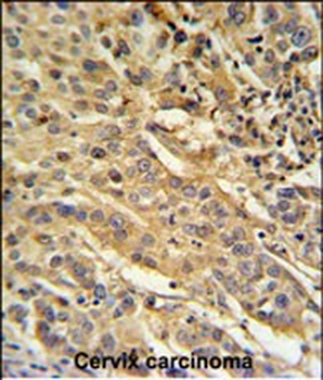 F91A1 Antibody (N-term)