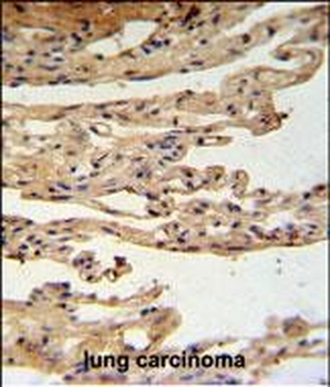 FKBPL Antibody (C-term)