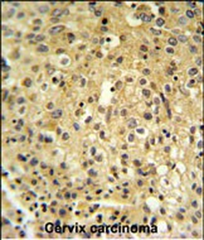 FYTD1 Antibody (N-term)