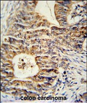 KLHL24 Antibody (Center)