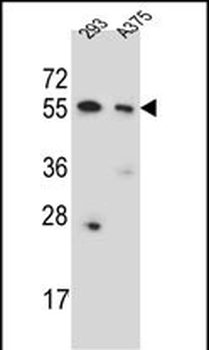 CPNE8 Antibody (N-term)