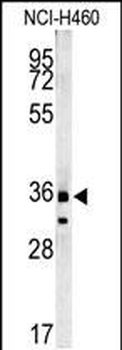 FA49A Antibody (N-term)