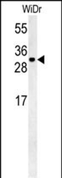 TM2D3 Antibody (N-term)