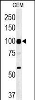 ATP6V0A4 Antibody (Center)