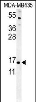 ENY2 Antibody (N-term)